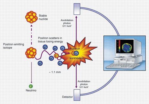 Schema della La tomografia ad emissione di positroni (PET)